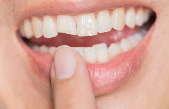 knocked out tooth